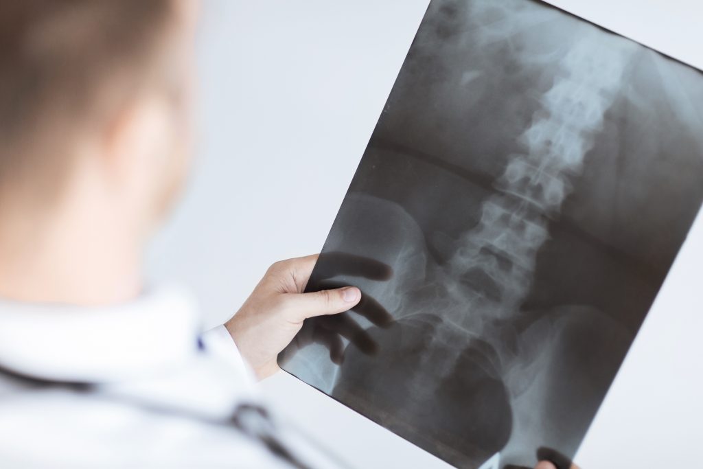 647888ca92d03e3fca3f2367 xray20back